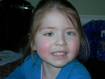 Ella's new eye.jpg