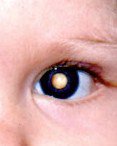 Eye.jpg